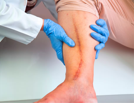 Fisioterapia com especialista em Pós-operatório